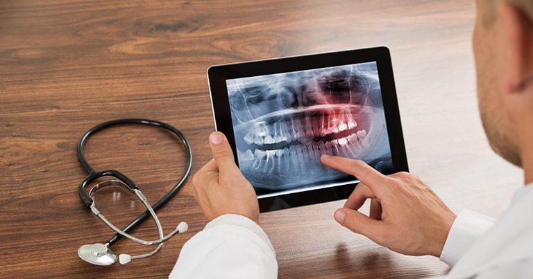 common dental problems | problemas dentales marbella
