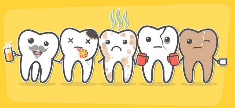 tooth decay marbella | caries dental