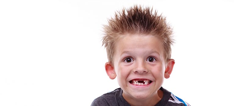 Child Losing Teeth